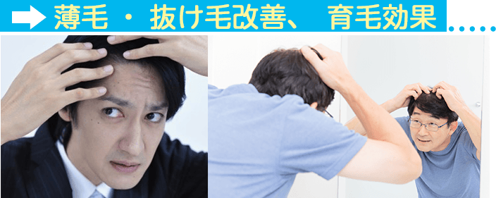 プラセンタサプリ効果その1〜薄毛・抜け毛改善、育毛効果